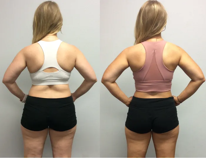 Omalza Fitness Picture 10