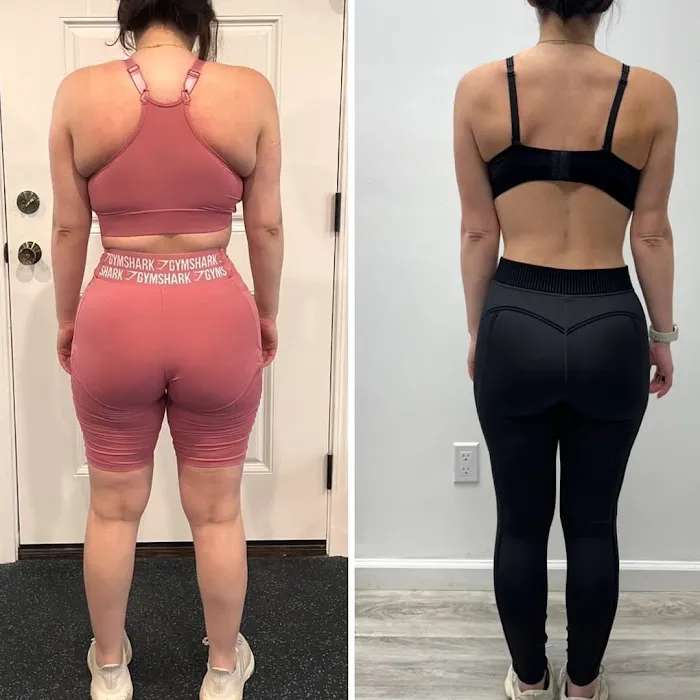 Gluteology Picture 5