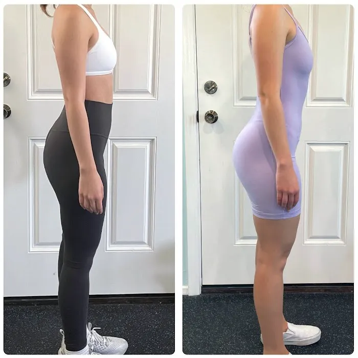 Gluteology Picture 2