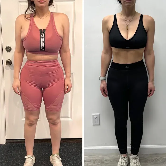 Gluteology Picture 8