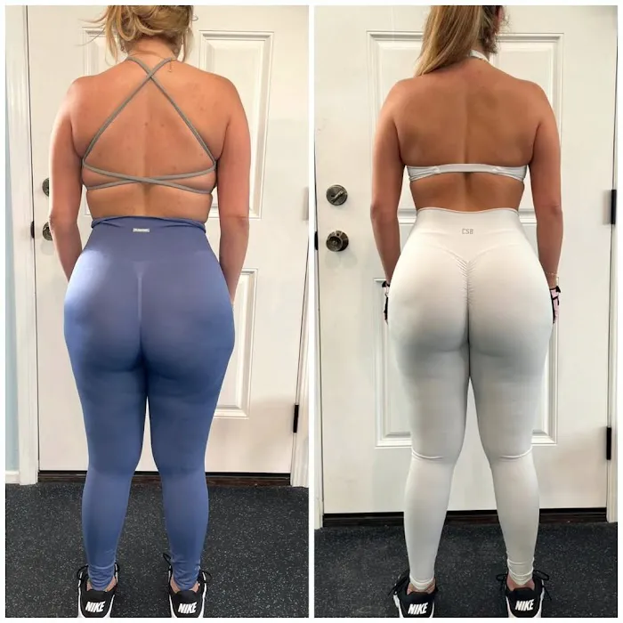 Gluteology Picture 7